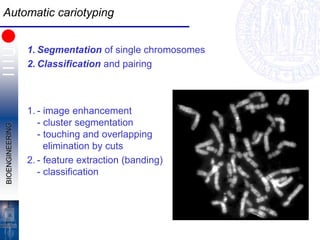 BIOENGINEERING
Automatic cariotyping
1. Segmentation of single chromosomes
2. Classification and pairing
1. - image enhancement
- cluster segmentation
- touching and overlapping
elimination by cuts
2. - feature extraction (banding)
- classification
 