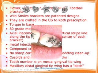 • Flower, Heart, Star, Soccer-ball and Football
brackets
• Wild Smiles brackets are patented designs
• They are crafted in the US to Roth prescription.
• Torque in base
• 80 grade mesh bonding base
• Axial Placement Technology (vertical stripe line
along the tip angle through the center of each
bracket)
• metal injection molding
• Compound contoured surfaces
• No sharp corners provide easy bonding clean-up
• Cuspids and premolars have hooks
• Tooth number is on mesial gingival tie wing
• Maxillary distal gingival tie wing has a "dash"
www.indiandentalacademy.co
m
 