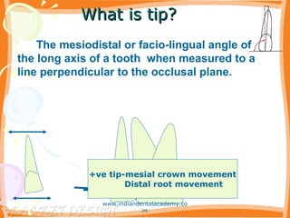 What is tip?What is tip?
+ve tip-mesial crown movement
Distal root movement
The mesiodistal or facio-lingual angle of
the long axis of a tooth when measured to a
line perpendicular to the occlusal plane.
www.indiandentalacademy.co
m
 