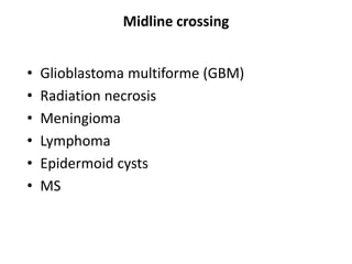 Midline crossing
• Glioblastoma multiforme (GBM)
• Radiation necrosis
• Meningioma
• Lymphoma
• Epidermoid cysts
• MS
 