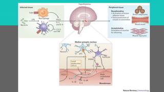 BROQUIECTASIA 
