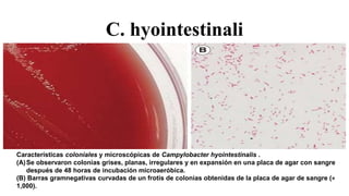 C. hyointestinali
Características coloniales y microscópicas de Campylobacter hyointestinalis .
(A)Se observaron colonias grises, planas, irregulares y en expansión en una placa de agar con sangre
después de 48 horas de incubación microaeróbica.
(B) Barras gramnegativas curvadas de un frotis de colonias obtenidas de la placa de agar de sangre (×
1,000).
 