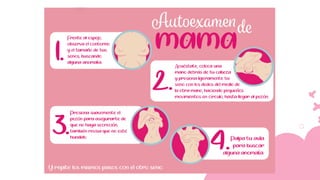 Cáncer de mama.pdf Cancer de mama Cancer de mama
