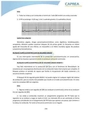 216
ECG:
1.- Todas las ondas p son conducidas al ventrículo. Cada QRS tendrá una onda p asociada.
2.- El PR se prolonga > 0,20 seg. (> de 1 cuadrado grande o 5 cuadraditos chicos)
ASPECTOS CLÍNICOS
Maniobras vágales, drogas parasimpaticomiméticas como digitálicos, betabloqueador,
verapamilo, diltiazem pueden ocasionar bloqueo AV de primer grado. Es frecuente en infarto
agudo del miocardio de cara inferior, en miocarditis o en fiebre reumática aguda. No produce
compromiso hemodinámico.
BLOQUEO AURÍCULOVENTRICULAR DE SEGUNDO GRADO
Es una interrupción intermitente de la conducción auriculoventricular; en consecuencia,
algunos de los impulsos supraventriculares no producen activación ventricular.
BLOQUEO AURÍCULOVENTRICULAR DE SEGUNDO GRADO MOBITZ I
Hay falla intermitente en la conducción AV pero con el fenómeno de Wenckebach. Se
caracteriza por una progresiva disminución de la conducción hasta interrumpirse por completo. El
bloqueo produce un período de reposo que facilita la recuperación del tejido conductor y la
secuencia tiende a repetirse.
El bloqueo AV de segundo grado Mobitz I se puede originar en cualquier región del sistema
de conducción, pero es mucho más probable que resulte en el nodo auriculoventricular. En estos
casos los complejos QRS son angostos.
ECG:
1.- Algunas ondas p van seguidas de QRS (se conducen al ventrículo) y otras no se conducen
(no son seguidas de QRS)
2.- Las ondas p conducidas muestran un alargamiento progresivo del PR hasta que la
siguiente no se conduce y luego se repite el ciclo. Los intervalos RR se van acortando en forma
progresiva coincidiendo con el alargamiento del PR hasta que aparece una pausa, que contiene a
la onda p no conducida. Por tanto la frecuencia ventricular se ve irregular.
 