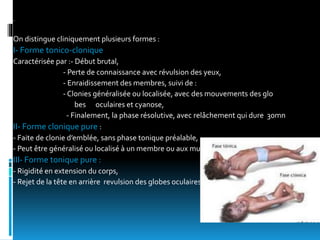 .
On distingue cliniquement plusieurs formes :
I- Forme tonico-clonique
Caractérisée par :- Début brutal,
- Perte de connaissance avec révulsion des yeux,
- Enraidissement des membres, suivi de :
- Clonies généralisée ou localisée, avec des mouvements des glo
bes oculaires et cyanose,
- Finalement, la phase résolutive, avec relâchement qui dure 30mn
II- Forme clonique pure :
- Faite de clonie d’emblée, sans phase tonique préalable,
- Peut être généralisé ou localisé à un membre ou aux muscles de la face.
III- Forme tonique pure :
- Rigidité en extension du corps,
- Rejet de la tête en arrière revulsion des globes oculaires
 