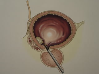 Cavesical