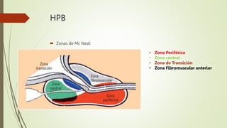 HPB
 Zonas de Mc Neal:
• Zona Periférica
• Zona central
• Zona de Transición
• Zona Fibromuscular anterior
 