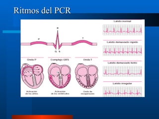 Ritmos del PCR
 