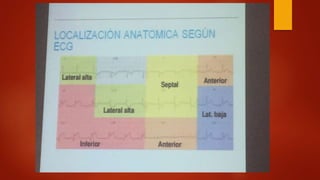 Código infarto