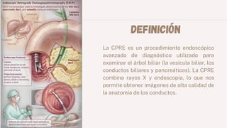 Definición
La CPRE es un procedimiento endoscópico
avanzado de diagnóstico utilizado para
examinar el árbol biliar (la vesícula biliar, los
conductos biliares y pancreáticos). La CPRE
combina rayos X y endoscopia, lo que nos
permite obtener imágenes de alta calidad de
la anatomía de los conductos.
 