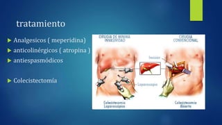 tratamiento
 Analgesicos ( meperidina)
 anticolinérgicos ( atropina )
 antiespasmódicos
 Colecistectomía
 