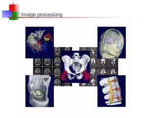 Image processing
 