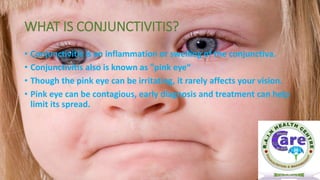 WHAT IS CONJUNCTIVITIS?
• Conjunctivitis is an inflammation or swelling of the conjunctiva.
• Conjunctivitis also is known as "pink eye“
• Though the pink eye can be irritating, it rarely affects your vision.
• Pink eye can be contagious, early diagnosis and treatment can help
limit its spread.
 