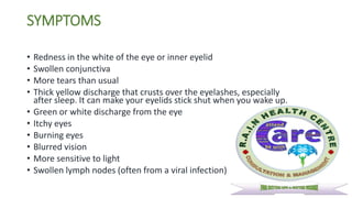 SYMPTOMS
• Redness in the white of the eye or inner eyelid
• Swollen conjunctiva
• More tears than usual
• Thick yellow discharge that crusts over the eyelashes, especially
after sleep. It can make your eyelids stick shut when you wake up.
• Green or white discharge from the eye
• Itchy eyes
• Burning eyes
• Blurred vision
• More sensitive to light
• Swollen lymph nodes (often from a viral infection)
 
