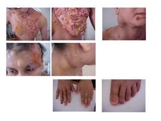 cours dermatophytes+mlassezia -epu 27-10- 2020.pdf