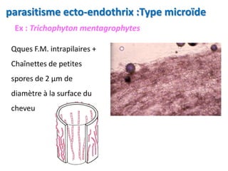 Ex : Trichophyton mentagrophytes
Qques F.M. intrapilaires +
Chaînettes de petites
spores de 2 µm de
diamètre à la surface du
cheveu
parasitisme ecto-endothrix :Type microïde
 