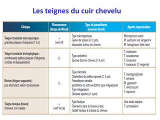 Les teignes du cuir chevelu
 