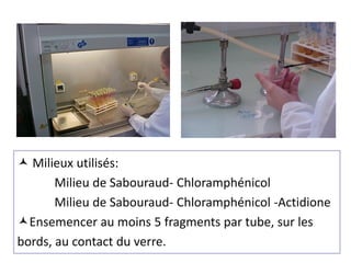  Milieux utilisés:
Milieu de Sabouraud- Chloramphénicol
Milieu de Sabouraud- Chloramphénicol -Actidione
Ensemencer au moins 5 fragments par tube, sur les
bords, au contact du verre.
 