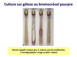 Culture sur gélose au bromocrésol pourpre
Témoin négatif: couleur gris; T. rubrum: pas de modification
T. mentagrophytes: virage au bleu- violacé
 