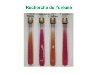 Recherche de l’uréase
 