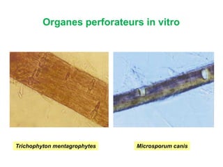 Organes perforateurs in vitro
Trichophyton mentagrophytes Microsporum canis
 
