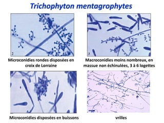 Microconidies rondes disposées en
croix de Lorraine
Microconidies disposées en buissons
Macroconidies moins nombreux, en
massue non échinulées, 3 à 6 logettes
vrilles
Trichophyton mentagrophytes
 