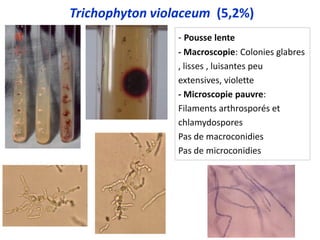 - Pousse lente
- Macroscopie: Colonies glabres
, lisses , luisantes peu
extensives, violette
- Microscopie pauvre:
Filaments arthrosporés et
chlamydospores
Pas de macroconidies
Pas de microconidies
Trichophyton violaceum (5,2%)
 