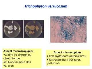Trichophyton verrucosum
Aspect macroscopique:
Glabre ou cireuse, ou
cérébriforme
R. blanc ou brun clair
V. brun
Aspect microscopique:
 Chlamydospores intercalaires
 Microconidies : très rares,
piriformes
 