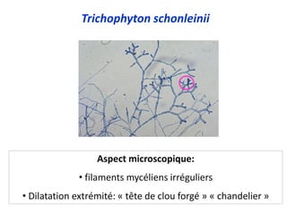 Trichophyton schonleinii
Aspect microscopique:
• filaments mycéliens irréguliers
• Dilatation extrémité: « tête de clou forgé » « chandelier »
 