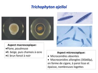 Trichophyton ajelloi
Aspect macroscopique:
Plane, poudreuse
R. beige, puis chamois à ocre
V. brun foncé à noir
Aspect microscopique:
 Microconidies absentes
 Macroconidies allongées (30à60µ),
en forme de cigare, à paroi lisse et
épaisse, nombreuses logettes
 
