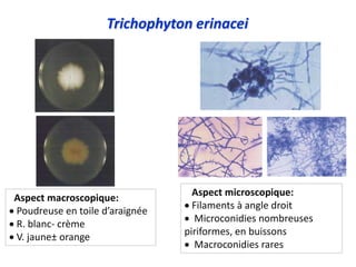 Trichophyton erinacei
Aspect macroscopique:
 Poudreuse en toile d’araignée
 R. blanc- crème
 V. jaune± orange
Aspect microscopique:
 Filaments à angle droit
 Microconidies nombreuses
piriformes, en buissons
 Macroconidies rares
 