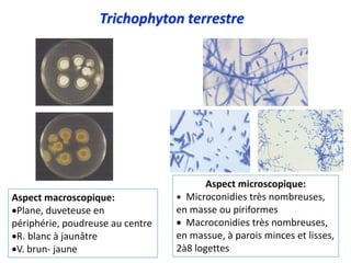 Trichophyton terrestre
Aspect macroscopique:
Plane, duveteuse en
périphérie, poudreuse au centre
R. blanc à jaunâtre
V. brun- jaune
Aspect microscopique:
 Microconidies très nombreuses,
en masse ou piriformes
 Macroconidies très nombreuses,
en massue, à parois minces et lisses,
2à8 logettes
 