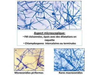 Aspect microscopique:
• FM cloisonnées, épais avec des dilatations en
raquette
• Chlamydospores intercalaires ou terminales
Microconidies piriformes Rares macroconidies
 