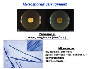 Microsporum ferrugineum
Macroscopie:
Glabre, orangé-rouille (verso/recto)
Microscopie:
• FM réguliers, cloisonées
Septas accentuées: « tiges de bambou »
• Ni microconidies
• Ni macroconidies
 