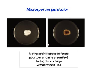 Microsporum persicolor
Macroscopie: aspect de feutre
pourtour arrondie et surélevé
Recto; blanc à beige
Verso: rosée à lilas
 