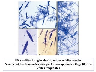 FM ramifiés à angles droits , microconidies rondes
Macroconidies lancéolées avec parfois un appendice flagelliforme
Vrilles fréquentes
 