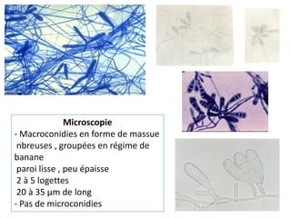 Microscopie
- Macroconidies en forme de massue
nbreuses , groupées en régime de
banane
paroi lisse , peu épaisse
2 à 5 logettes
20 à 35 µm de long
- Pas de microconidies
 
