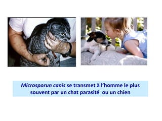 Microsporun canis se transmet à l’homme le plus
souvent par un chat parasité ou un chien
 