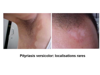 cours dermatophytes+mlassezia -epu 27-10- 2020.pdf