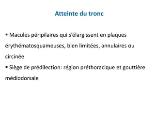 Atteinte du tronc
 Macules péripilaires qui s’élargissent en plaques
érythématosquameuses, bien limitées, annulaires ou
circinée
 Siège de prédilection: région préthoracique et gouttière
médiodorsale
 