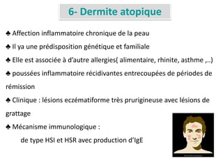 6- Dermite atopique
♣ Affection inflammatoire chronique de la peau
♣ Il ya une prédisposition génétique et familiale
♣ Elle est associée à d’autre allergies( alimentaire, rhinite, asthme ,..)
♣ poussées inflammatoire récidivantes entrecoupées de périodes de
rémission
♣ Clinique : lésions eczématiforme très prurigineuse avec lésions de
grattage
♣ Mécanisme immunologique :
de type HSI et HSR avec production d’IgE
 