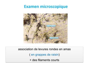 association de levures rondes en amas
( en grappes de raisin)
+ des filaments courts
Examen microscopique
 