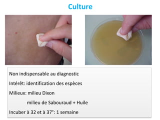 Non indispensable au diagnostic
Intérêt: identification des espèces
Milieux: milieu Dixon
milieu de Sabouraud + Huile
Incuber à 32 et à 37°: 1 semaine
Culture
 