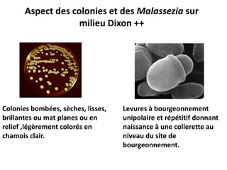 Aspect des colonies et des Malassezia sur
milieu Dixon ++
Colonies bombées, sèches, lisses,
brillantes ou mat planes ou en
relief ,légèrement colorés en
chamois clair.
Levures à bourgeonnement
unipolaire et répétitif donnant
naissance à une collerette au
niveau du site de
bourgeonnement.
 
