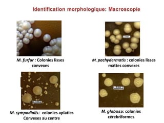 M. furfur : Colonies lisses
convexes
M. pachydermatis : colonies lisses
mattes convexes
M. sympodialis: colonies aplaties
Convexes au centre
M. globosa: colonies
cérebriformes
 