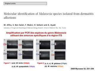2008 Mycoses 52, 251–256
 