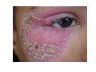 cours dermatophytes+mlassezia -epu 27-10- 2020.pdf