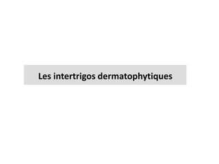 Les intertrigos dermatophytiques
 
