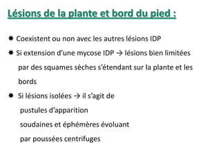 Lésions de la plante et bord du pied :
 Coexistent ou non avec les autres lésions IDP
 Si extension d’une mycose IDP → lésions bien limitées
par des squames sèches s’étendant sur la plante et les
bords
 Si lésions isolées → il s’agit de
pustules d’apparition
soudaines et éphémères évoluant
par poussées centrifuges
 