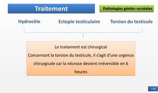 119
Pathologies génito--scrotales
Définition
Traitement
Hydrocèle Ectopie testiculaire
Le traitement est chirurgical
Concernant la torsion du testicule, il s’agit d’une urgence
chirurgicale car la nécrose devient irréversible en 6
heures
Torsion du testicule
 